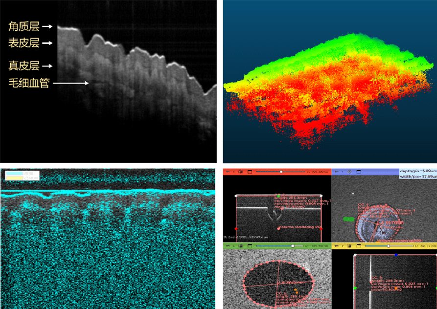 医疗图像与分析：人体皮肤分层结构AI图像处理与医美模拟皮肤表面小孔3D分析